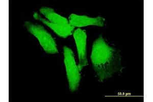 Immunofluorescence of purified MaxPab antibody to S100P on HeLa cell. (S100P 抗体  (AA 1-95))