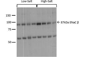 Western Blotting (WB) image for anti-Sodium Channel, Nonvoltage-Gated 1 alpha (SCNN1A) (AA 617-638) antibody (Atto 488) (ABIN2486401)