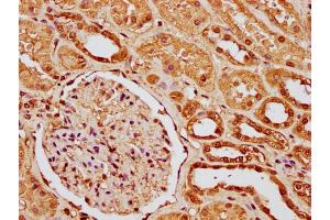 IHC image of nme1HU diluted at 1:10 and staining in paraffin-embedded human kidney tissue performed on a Leica BondTM system. (Histone H1-Like (LOC107807853) (AA 8-20) 抗体)