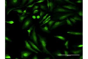 Immunofluorescence of monoclonal antibody to HGD on HeLa cell. (HGD 抗体  (AA 377-445))