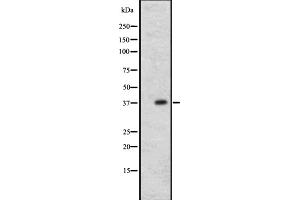 Western blot analysis of CCR1 expression in A431 whole cell lysate ,The lane on the left is treated with the antigen-specific peptide. (CCR1 抗体  (N-Term))