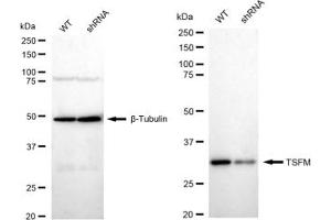 Western blotting analysis using TSFM antibody (ABIN7800656).