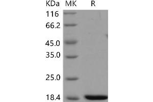 Regenerating Islet-Derived 3 beta (REG3B) protein (His tag)
