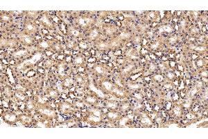 Detection of HK1 in Rat Kidney Tissue using Polyclonal Antibody to Hexokinase 1 (HK1) (Hexokinase 1 抗体  (AA 80-215))