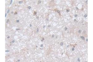 Immunohistochemistry (IHC) image for anti-Coactosin-Like Protein (AA 1-142) antibody (ABIN7436669)
