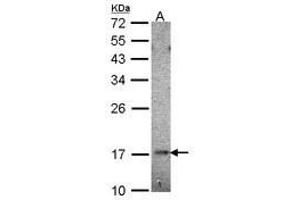Image no. 2 for anti-Ubiquitin-Conjugating Enzyme E2B (UBE2B) (AA 7-152) antibody (ABIN467405) (UBE2B 抗体  (AA 7-152))