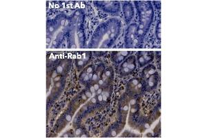 Immunohistochemistry (IHC) image for anti-RAB1A, Member RAS Oncogene Family (RAB1A) (C-Term) antibody (ABIN1440053) (RAB1A 抗体  (C-Term))