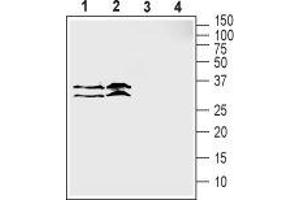 SLC39A3 抗体  (1st Extracellular Loop)