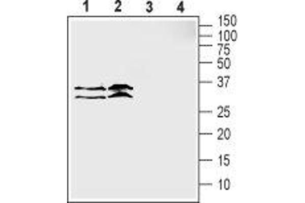 SLC39A3 抗体  (1st Extracellular Loop)