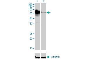 Western Blotting (WB) image for anti-Topoisomerase (DNA) III beta (TOP3B) (AA 1-862) antibody (ABIN563888)