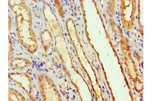 Immunohistochemistry of paraffin-embedded human kidney tissue using ABIN7160641 at dilution of 1:100 (MTMR14 抗体  (AA 1-280))