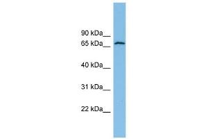 GLUD2 antibody used at 1 ug/ml to detect target protein. (GLUD2 抗体  (N-Term))