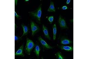 Immunofluorescent analysis of Aquaporin 4 staining in Hela cells. (Aquaporin 4 抗体)
