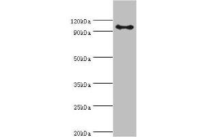 Western blot All lanes: AP-2 complex subunit beta antibody at 8 μg/mL + Mouse brain tissue Secondary Goat polyclonal to rabbit IgG at 1/10000 dilution Predicted band size: 105, 106, 99 kDa Observed band size: 105 kDa (AP2B1 抗体  (AA 738-937))
