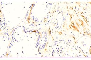 Sample Type: Normal Human Prostate Primary Antibody Dilution: 2 µg/mL Color/Signal Descriptions: TGM4 (DAB; brown), nuclei (hematoxylin; blue)  Gene Name: TGM4 (TGM4 抗体  (N-Term))