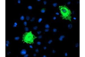 Anti-FBXO21 mouse monoclonal antibody (ABIN2455379) immunofluorescent staining of COS7 cells transiently transfected by pCMV6-ENTRY FBXO21 (RC223095). (FBXO21 抗体)