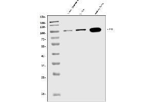 Western blot analysis of WFS1 using anti-WFS1 antibody (ABIN7602165).