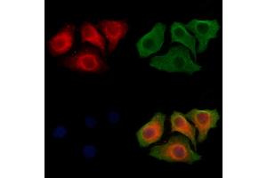 ABIN6264415 and ABIN6278511 staining Hela cells by IF/ICC. (SLC26A5 抗体  (Internal Region))