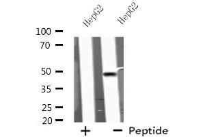 Western blot analysis of extracts from HepG2 cells, using KCNN4 antibody. (KCNN4 抗体  (C-Term))