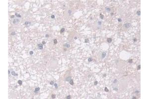 Immunohistochemistry (IHC) image for anti-Actin Related Protein 2/3 Complex, Subunit 2, 34kDa (ARPC2) (AA 1-300) antibody (ABIN7441580)