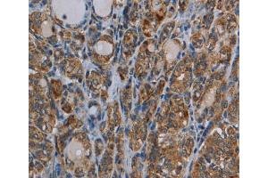 Immunohistochemistry (IHC) image for anti-Myosin VIIA (MYO7A) antibody (ABIN2435036) (Myosin VIIA 抗体)