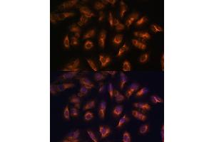 Immunofluorescence (IF) image for anti-Somatostatin Receptor 2 (SSTR2) (C-Term) antibody (ABIN7270493)