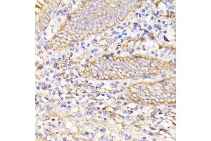Immunohistochemistry of paraffin-embedded human appendix using PSMG1 antibody (ABIN7269593) at dilution of 1:100 (40x lens). (PSMG1 抗体  (AA 1-288))