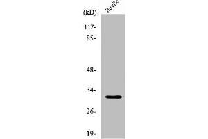 Western Blot analysis of HuvEc cells using DIO3 Polyclonal Antibody (DIO3 抗体  (Internal Region))