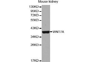 Western Blotting (WB) image for anti-Wingless-Type MMTV Integration Site Family, Member 7A (WNT7A) antibody (ABIN1876613) (WNT7A 抗体)