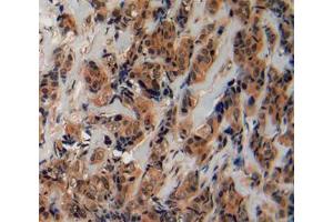 Used in DAB staining on fromalin fixed paraffin- embedded breast cancer tissue (Fibrillin 2 抗体  (AA 1550-1791))
