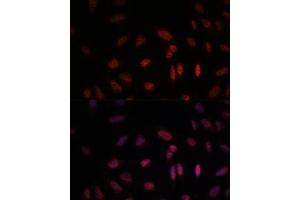 Immunofluorescence analysis of U-2 OS cells using WDR18 antibody (ABIN7271354) at dilution of 1:100. (WDR18 抗体  (AA 243-432))
