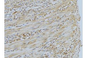 ABIN6275351 at 1/100 staining Mouse muscle tissue by IHC-P. (PEX7 抗体  (C-Term))