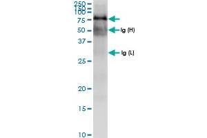 Immunoprecipitation of TRAP1 transfected lysate using anti-TRAP1 MaxPab rabbit polyclonal antibody and Protein A Magnetic Bead , and immunoblotted with TRAP1 MaxPab rabbit polyclonal antibody (D01) . (TRAP1 抗体  (AA 1-704))