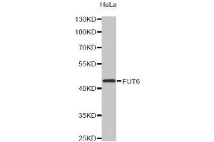 Western Blotting (WB) image for anti-Fucosyltransferase 6 (Alpha (1,3) Fucosyltransferase) (FUT6) antibody (ABIN1872749) (FUT6 抗体)