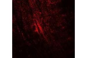 Immunofluorescence (IF) image for anti-Myosin Binding Protein C, Slow Type (MYBPC1) (N-Term) antibody (ABIN1450116)
