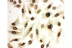ICC testing of HeLa cells (HOXA4 抗体  (N-Term))