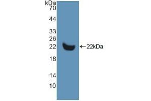 Western blot analysis of recombinant Human MMP13. (MMP13 抗体  (AA 290-468))