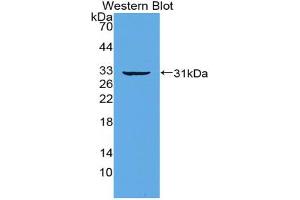 Western blot analysis of the recombinant protein. (IRF5 抗体  (AA 3-250))