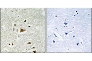Immunohistochemistry analysis of paraffin-embedded human brain tissue, using Smad2 (Ab-220) Antibody.