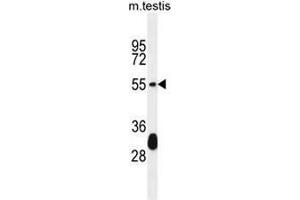 KT33A Antibody (N-term) western blot analysis in mouse testis tissue lysates (35µg/lane). (Keratin 33A 抗体  (N-Term))