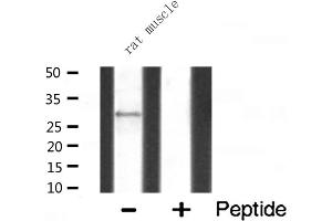 Western blot analysis of MRPL10 expression in Rat muscle lysate (MRPL10 抗体  (C-Term))