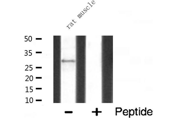 MRPL10 Antikörper  (C-Term)