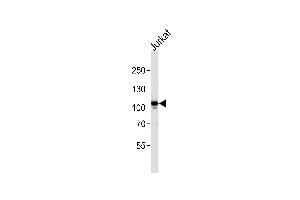 Western blot analysis in Jurkat cell line lysates (35ug/lane). (MERTK 抗体)