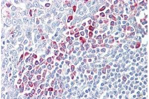 Anti-PARP6 antibody IHC staining of human tonsil. (PARP6 抗体  (AA 431-480))