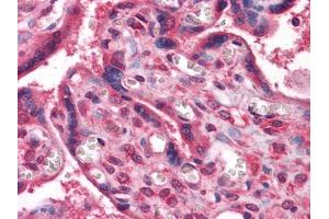 Immunohistochemistry (IHC) image for anti-Non-Metastatic Cells 1, Protein (NM23A) Expressed in (NME1) antibody (ABIN969317)