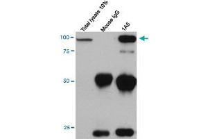 Immunoprecipitation of full length CDH11 over expression in L cell using CDH11 monoclonal antibody (M03), clone 1A5, and immunoblotted with CDH11 monoclonal antibody (Zymed).