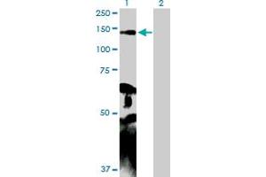 Western Blot analysis of MYLK expression in transfected 293T cell line by MYLK MaxPab polyclonal antibody. (MYLK 抗体  (AA 1-992))