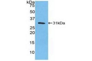 Western blot analysis of recombinant Human CA3. (CA3 抗体  (AA 2-260))