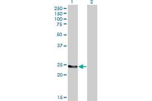Western Blot analysis of GSTM4 expression in transfected 293T cell line by GSTM4 monoclonal antibody (M01), clone 4B4. (GSTM4 抗体  (AA 23-119))