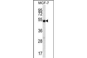 Western blot analysis in MCF-7 cell line lysates (35ug/lane). (Coilin 抗体  (AA 157-186))